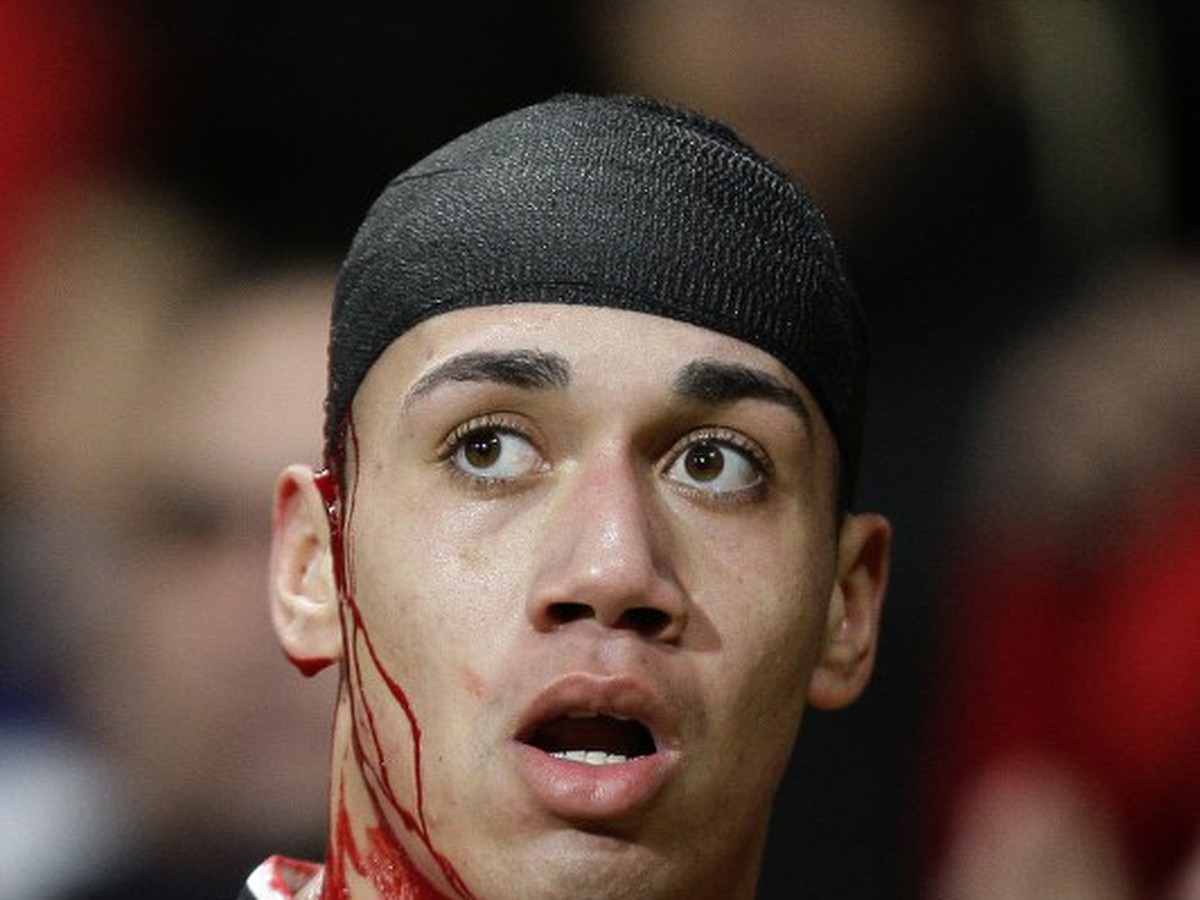 Chris Smalling 