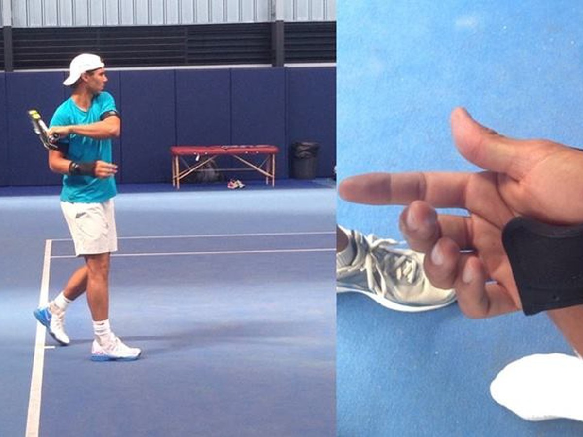 Rafael Nadal nútene vymenil hodinky na ruke za dlahu