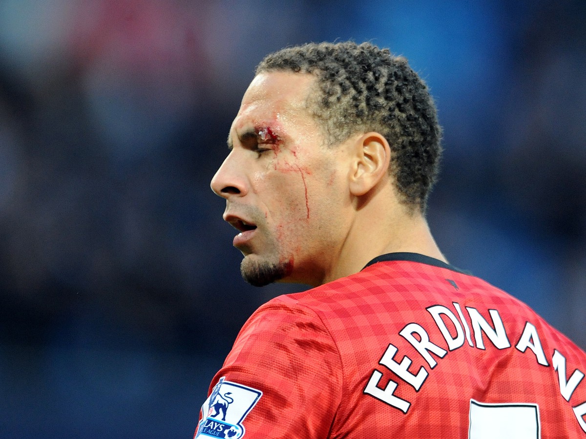 Ferdinand s krvou na tvári