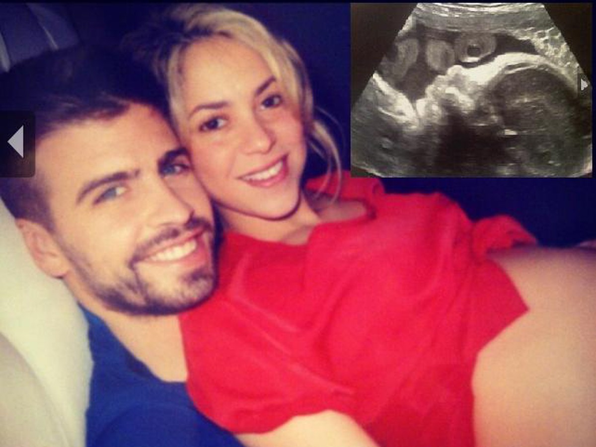 Shakira a Piqué zverejnili snímku ich dieťaťa z ultrazvuku