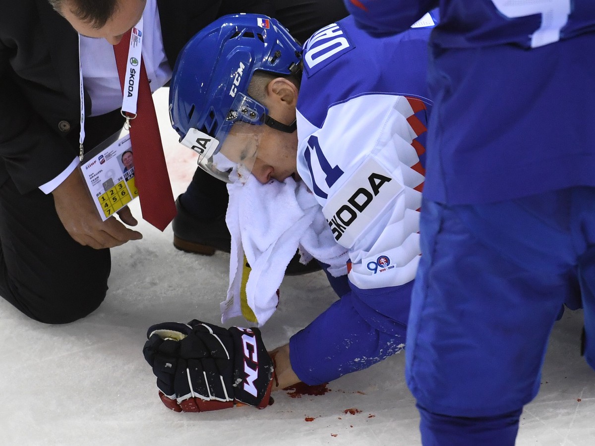 Na snímke zranený slovenský obranca Marek Ďaloga leží na ľadovej ploche 