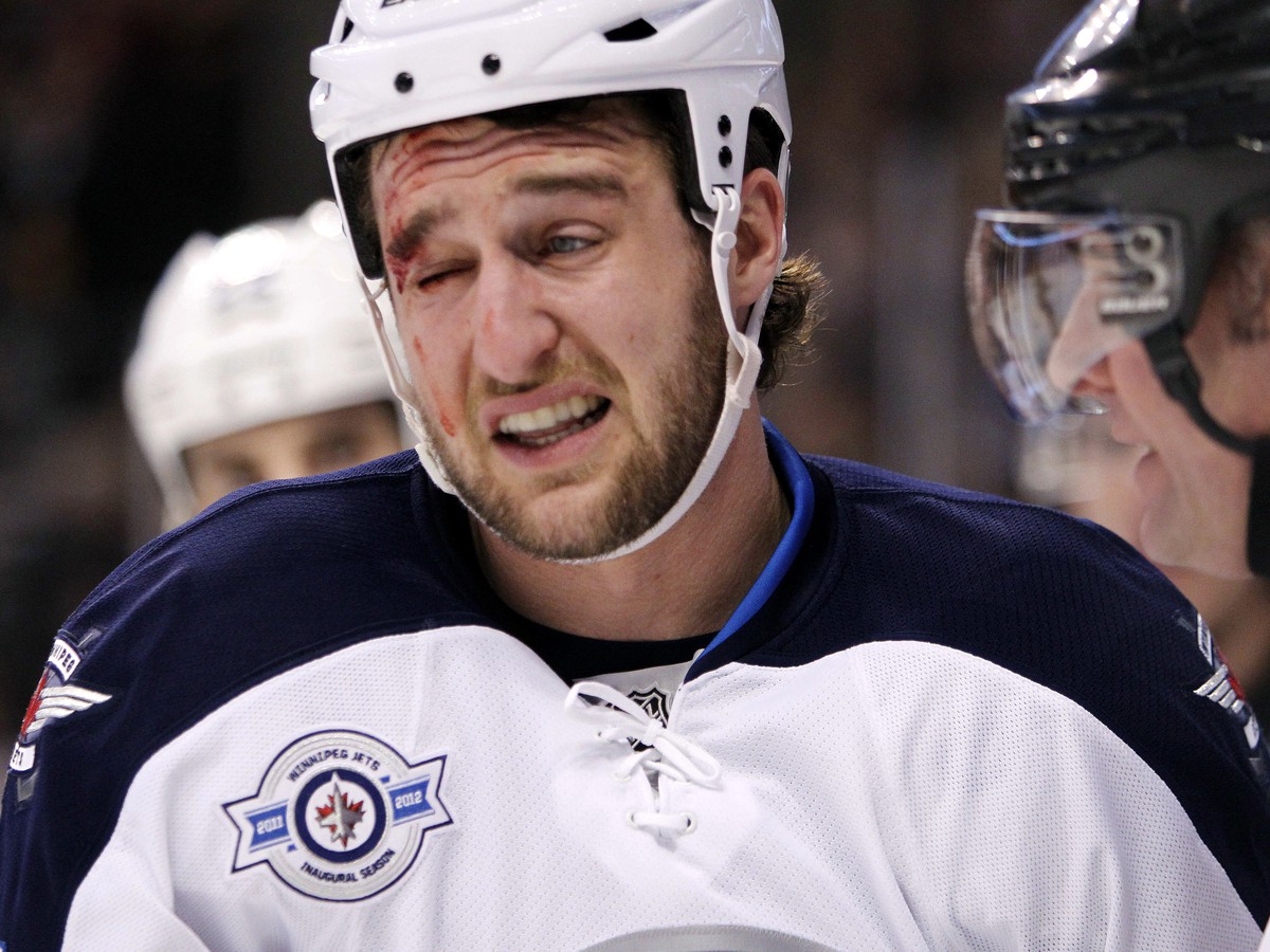 Tanner Glass patrí medzi nekompromisných hráčov