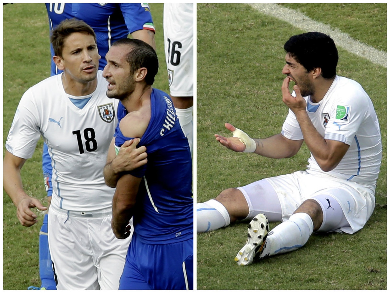 Suárez pohryzol talianskeho obrancu
