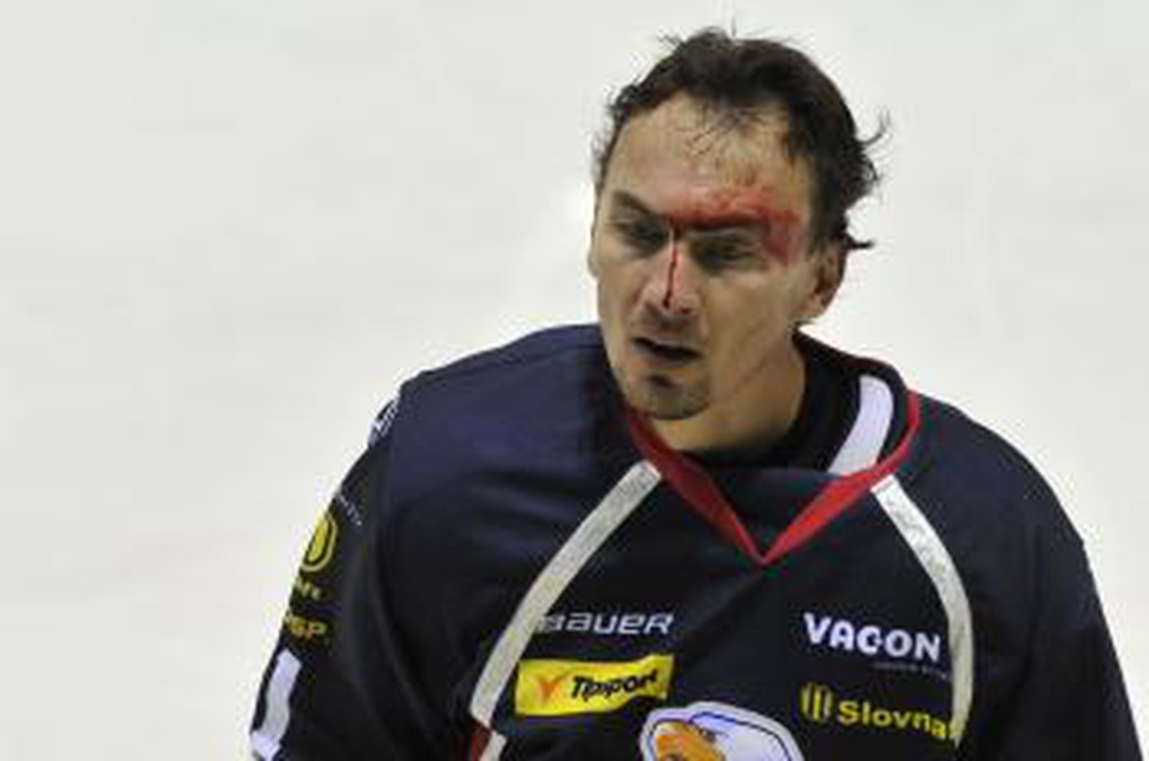 Zakrvavený Miroslav Šatan po