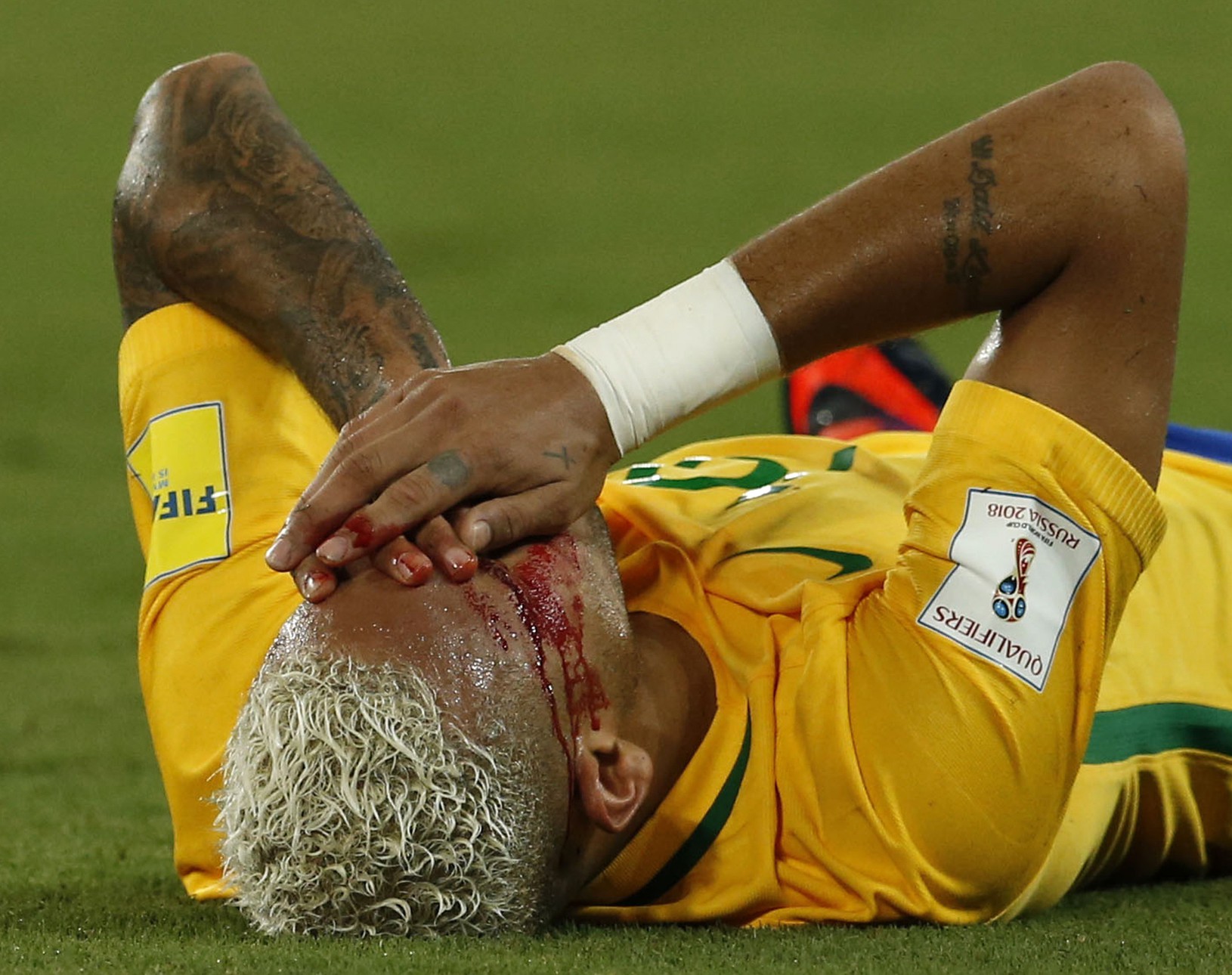 Neymar skončil so zakrvavenou