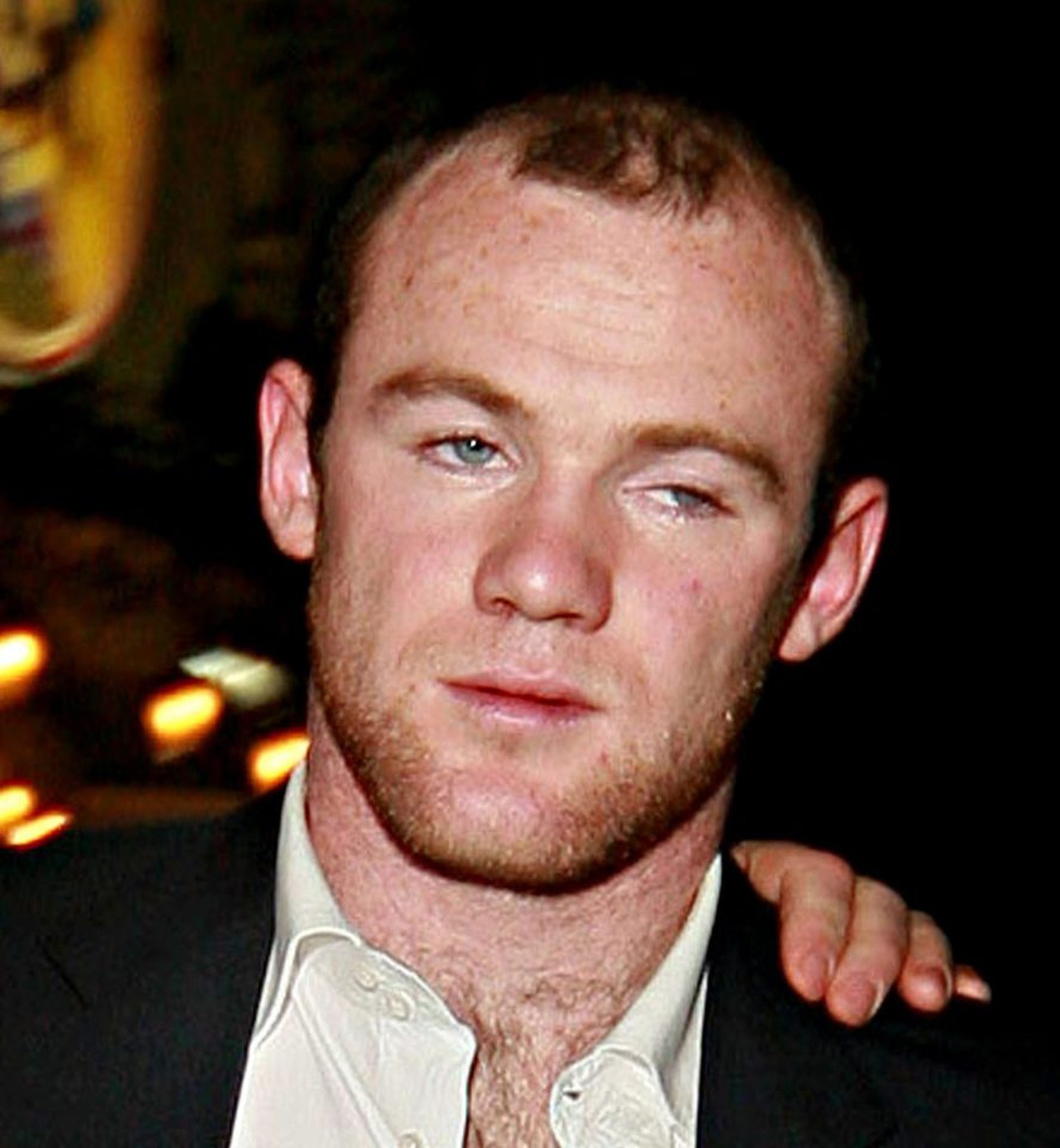 Wayne Rooney to prehnal