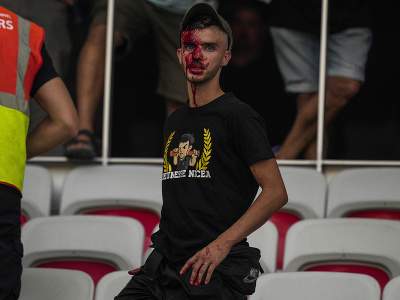 Na snímke zakrvavený fanúšik Nice po bitke s fanúšikmi Kolína na štadióne pred zápasom D-skupiny 1. kola skupinovej fázy EKL