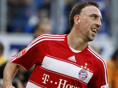 Franck Ribéry
