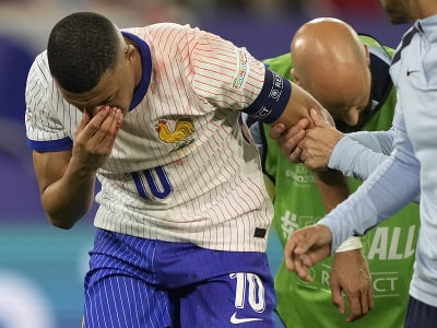 Francúzsky útočník Kylian Mbappé utrpel zlomeninu nosa