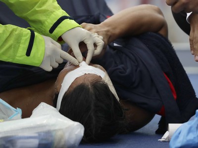Japonec Mitsuaki Shiga sa nepríjemne zranil počas súboja vo vodnom póle