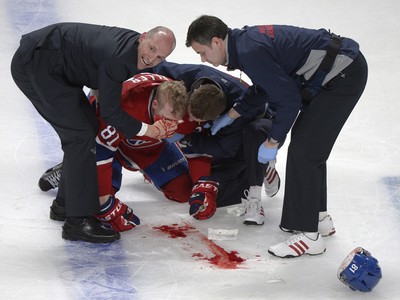 Lars Eller utrpel v súboji s Ottawou nepríjemné zranenie