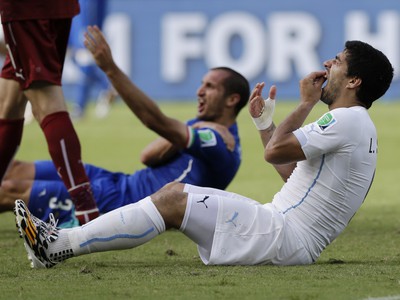 Luis Suárez sa drží za zuby potom, čo do ramena uhryzol Taliana Chielliniho