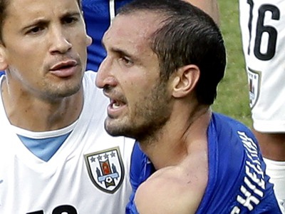 Suárez kusol talianskeho obrancu Chielliniho