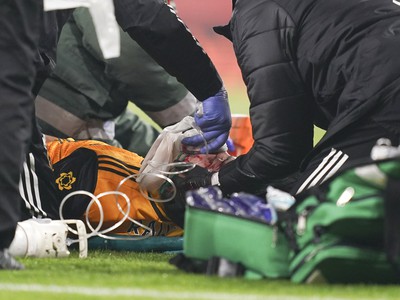 Mexický futbalista Raúl Jiménez utrpel na pôde Arsenalu Londýn fraktúru lebečnej kosti