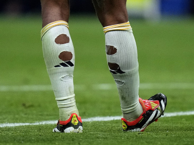 Deravé ponožky futbalistu Realu Madrid Judea Bellinghama, ktoré odfotili po zápase 19. kola španielskej La Ligy Real Madrid - RCD Mallorca
