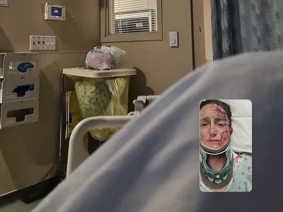 Zranená Katrina Matthewsová v nemocnici
