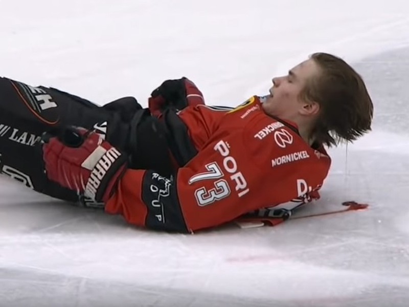 Otto Kivenmäki skončil po tvrdom náraze ležať na ľade s krvavou hlavou