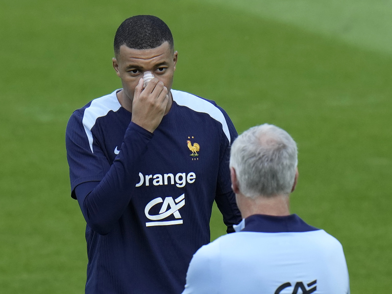 Kylian Mbappé na tréningu so zlomeným nosom