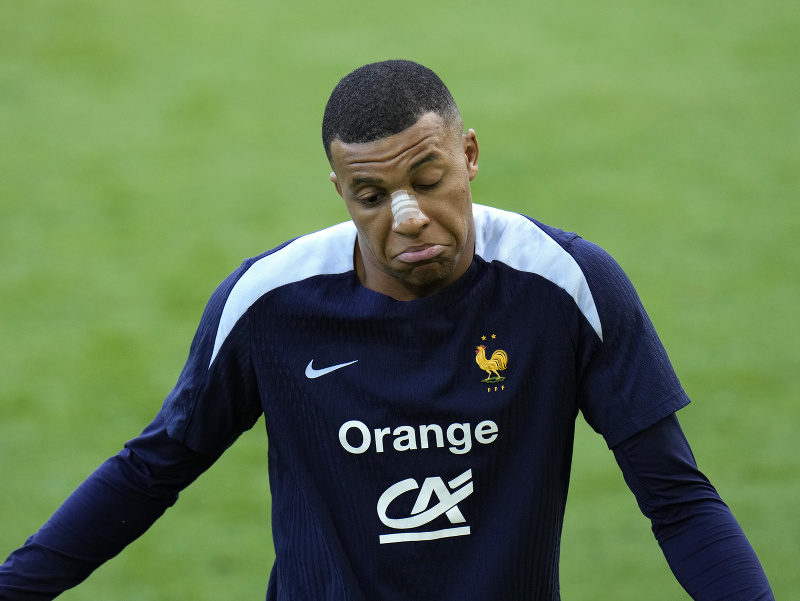 Kylian Mbappé na tréningu so zlomeným nosom