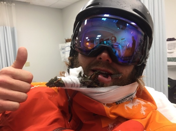 Zranený inštruktor lyžovania