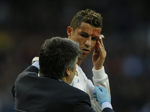 Zranený Ronaldo